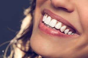 Gum Contouring: A Viable Solution to Gum Issues