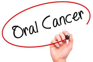 What You Need to Know About Mouth Cancer