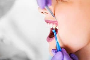 Why Your Gums Hurt and Bleed (and What to do About it)