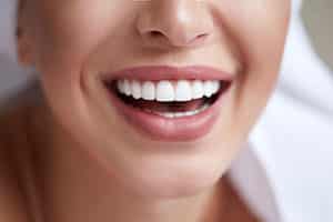Woman smiling with perfect veneers.