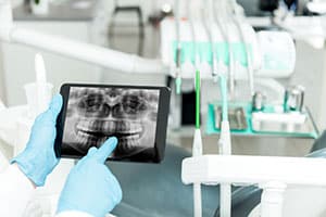 Dentist looking at x-rays of patients teeth.