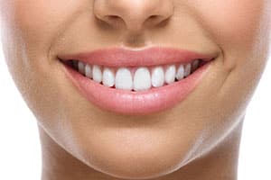 Give Your Mouth the “Spa” Treatment in Our Teeth Whitening Spa!