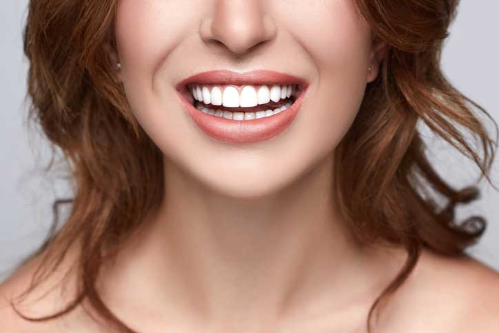 Who Could Benefit from Porcelain Veneers?