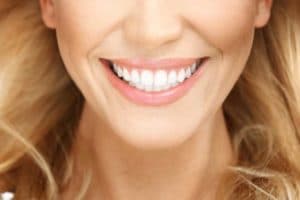 Closeup of blonde woman with perfect smile.