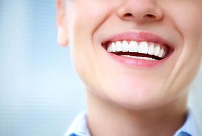 Woman Smiling with Lumineers for Teeth Whitening near Franklin MI