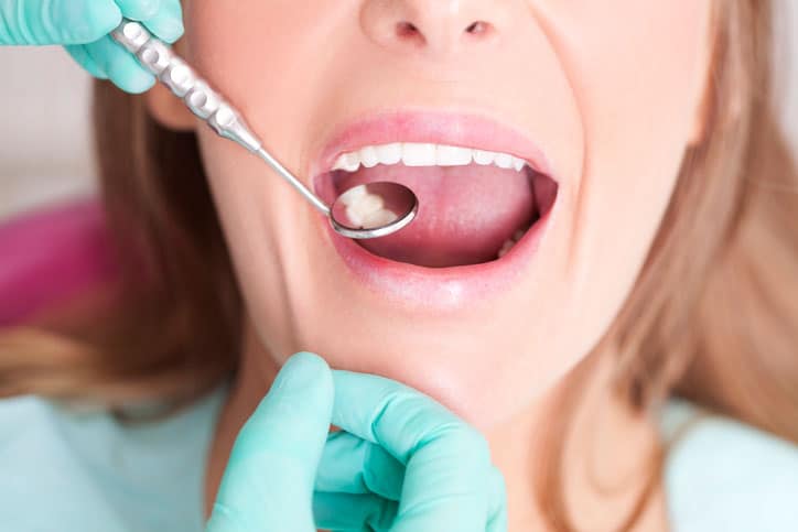 Dental Mirror Closeup In Woman's Mouth