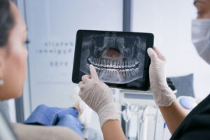 Looking at Dental X-ray