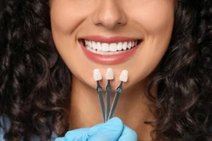 getting-Porcelain-Veneers-in-MI