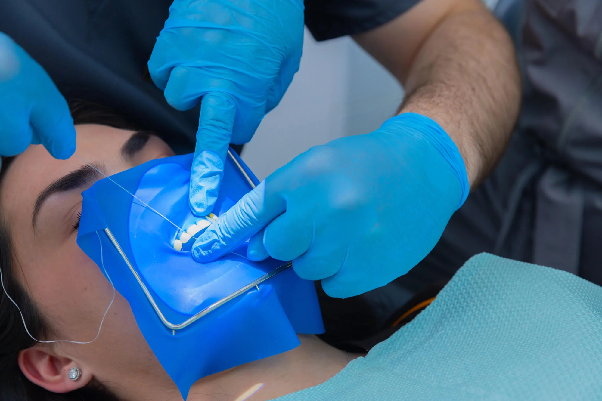 Patient under teeth cleaning in Birmingham, MI.