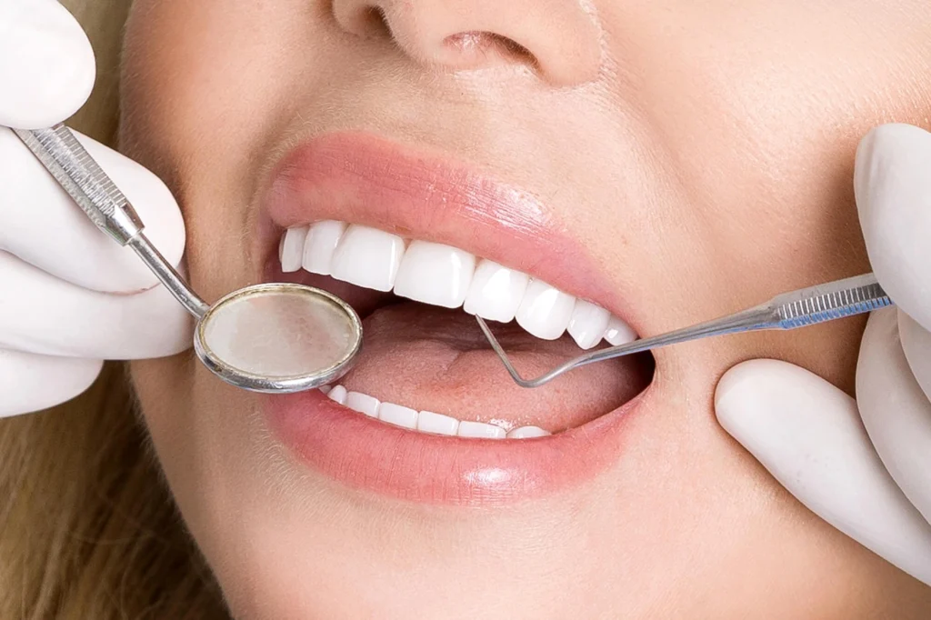 Woman Receiving Porcelain Veneers in MI Treatment
